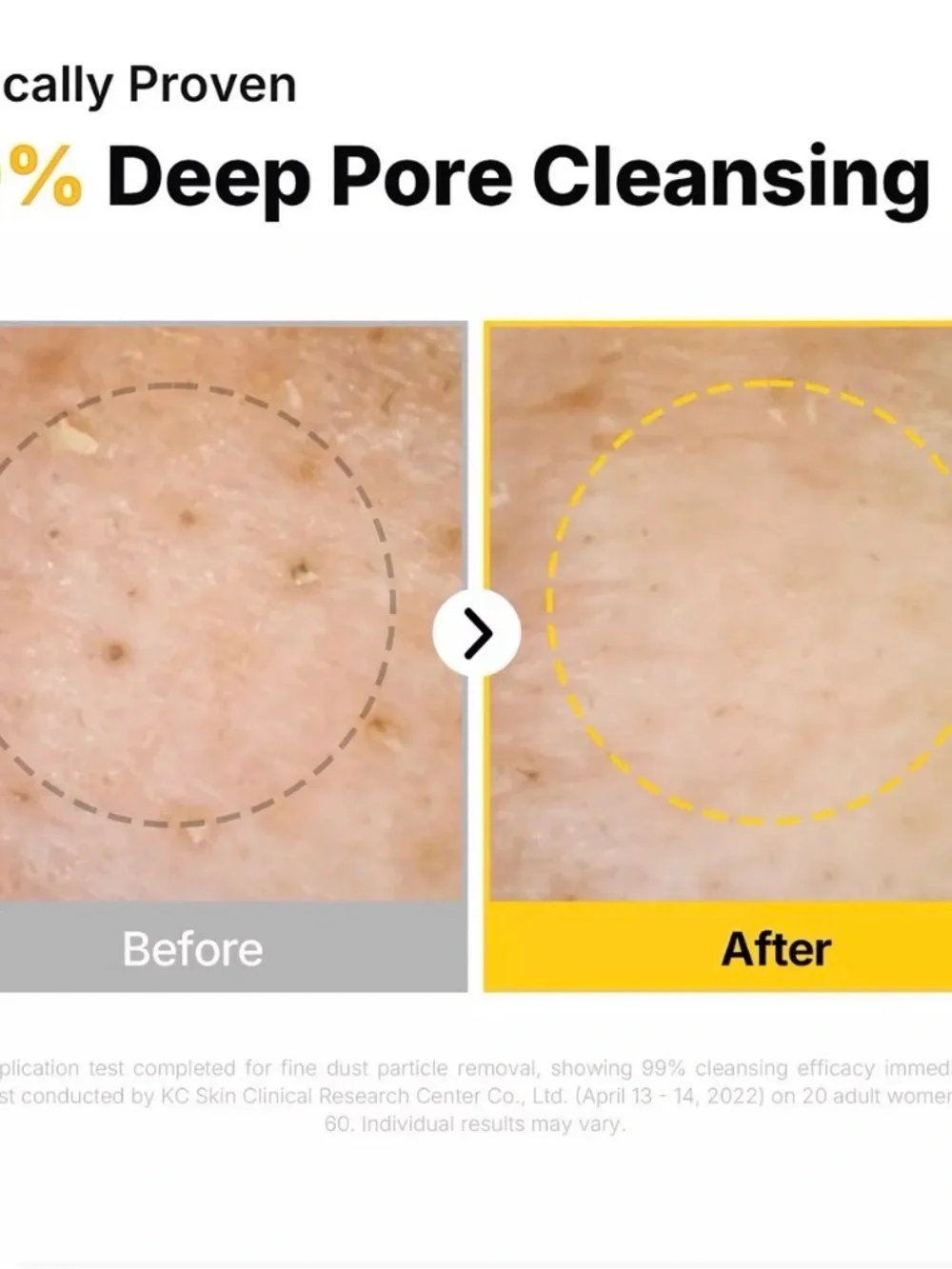 Ma:nyo cleansing Oil Anti-Blackhead .84 oz travel size